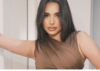 Gabi Kovalski corrige assimetria e flacidez com PMMA