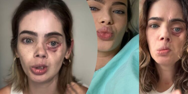 Câncer bucal avança de forma silenciosa no Brasil e diagnóstico tardio ainda causa mutilações e impacto social